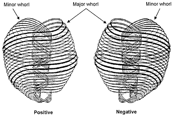 Matter Subquark with Ten Closed Strings